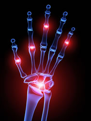 arthritis and chiropractic noblesville