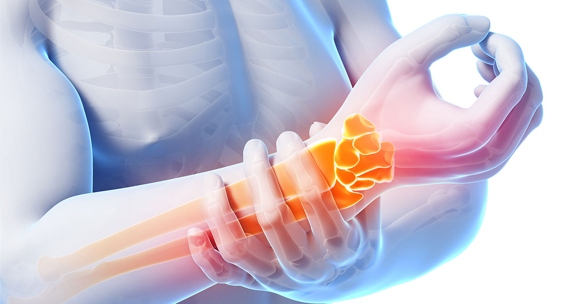 Noblesville natural carpal tunnel treatment