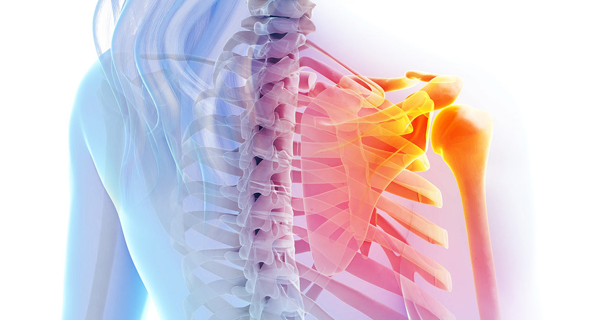 Noblesville shoulder pain treatment and recovery