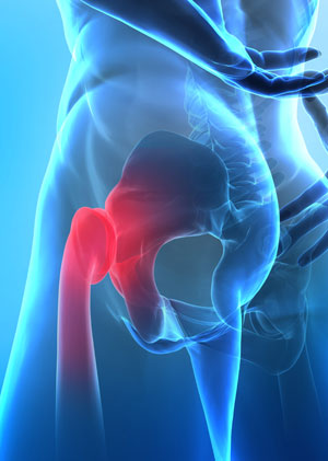 Immediate Relief of Hip Pain After Manual Therapy 
